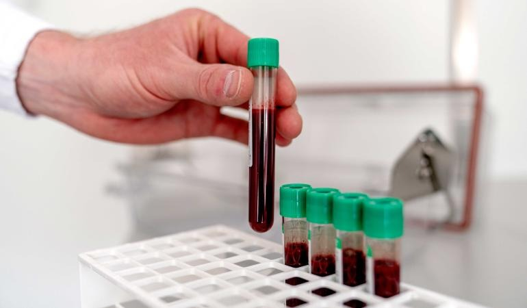 RIVM maakt resultaten eerste landelijke onderzoek naar PFAS in bloed bekend